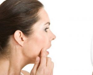 激素脸，激素依赖性皮炎的症状表现