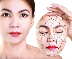 为什么患有激素依赖性皮炎的脸会干到出现脱皮？怎样缓解脸干、脱皮的激素脸症状?